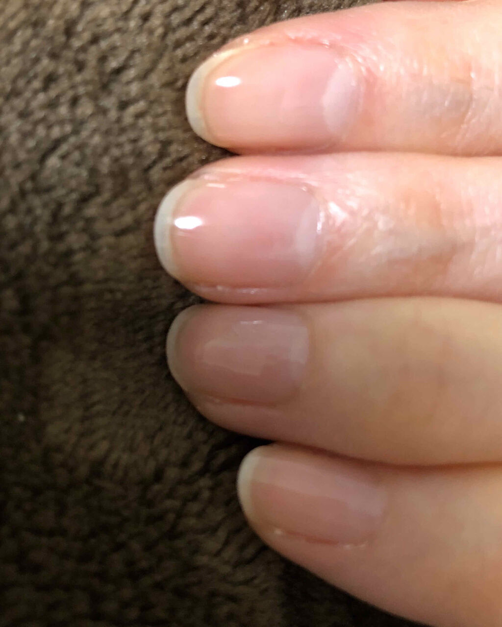 ウィンマックス ネイルハードナー/DAISO/ネイルオイル・トリートメントを使ったクチコミ（2枚目）