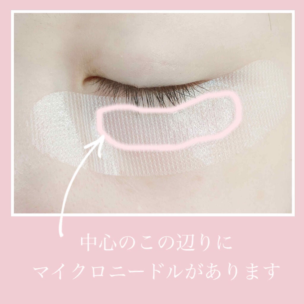 ナチュラベーレ THEマイクロニードル/ナチュラベーレ/シートマスク・パックを使ったクチコミ(4枚目)