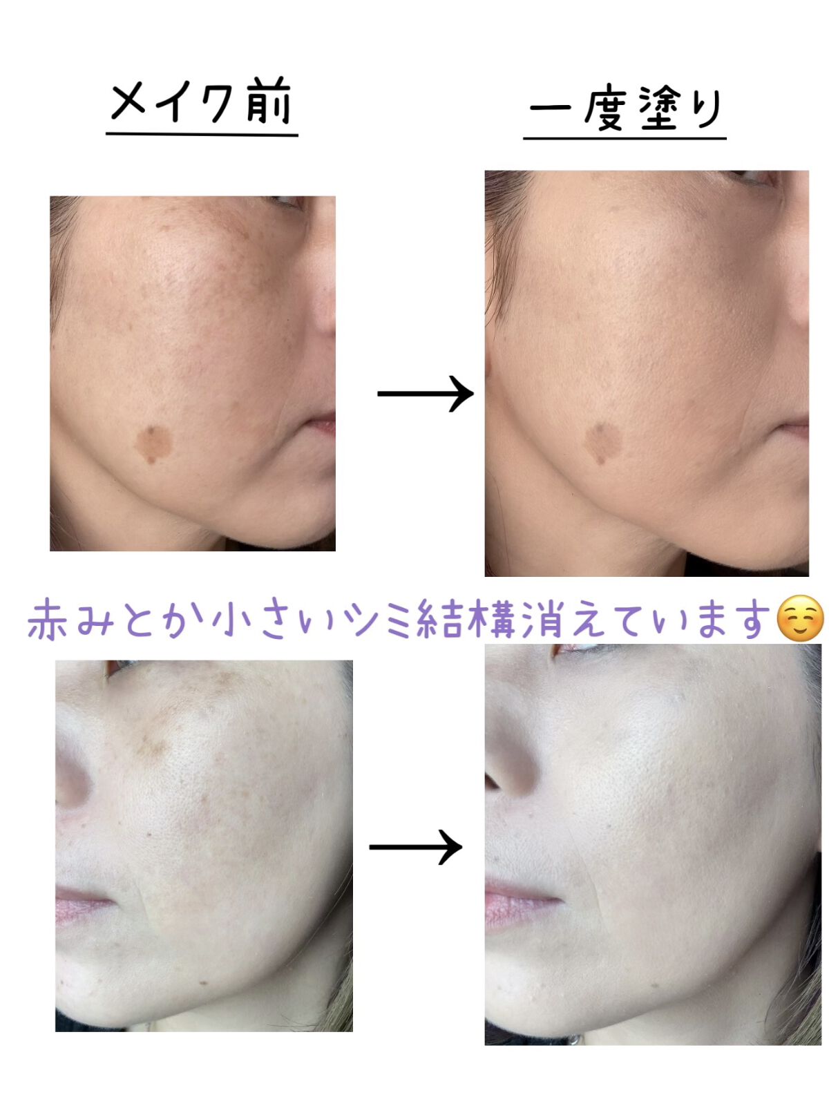 を使ったクチコミ（3枚目）