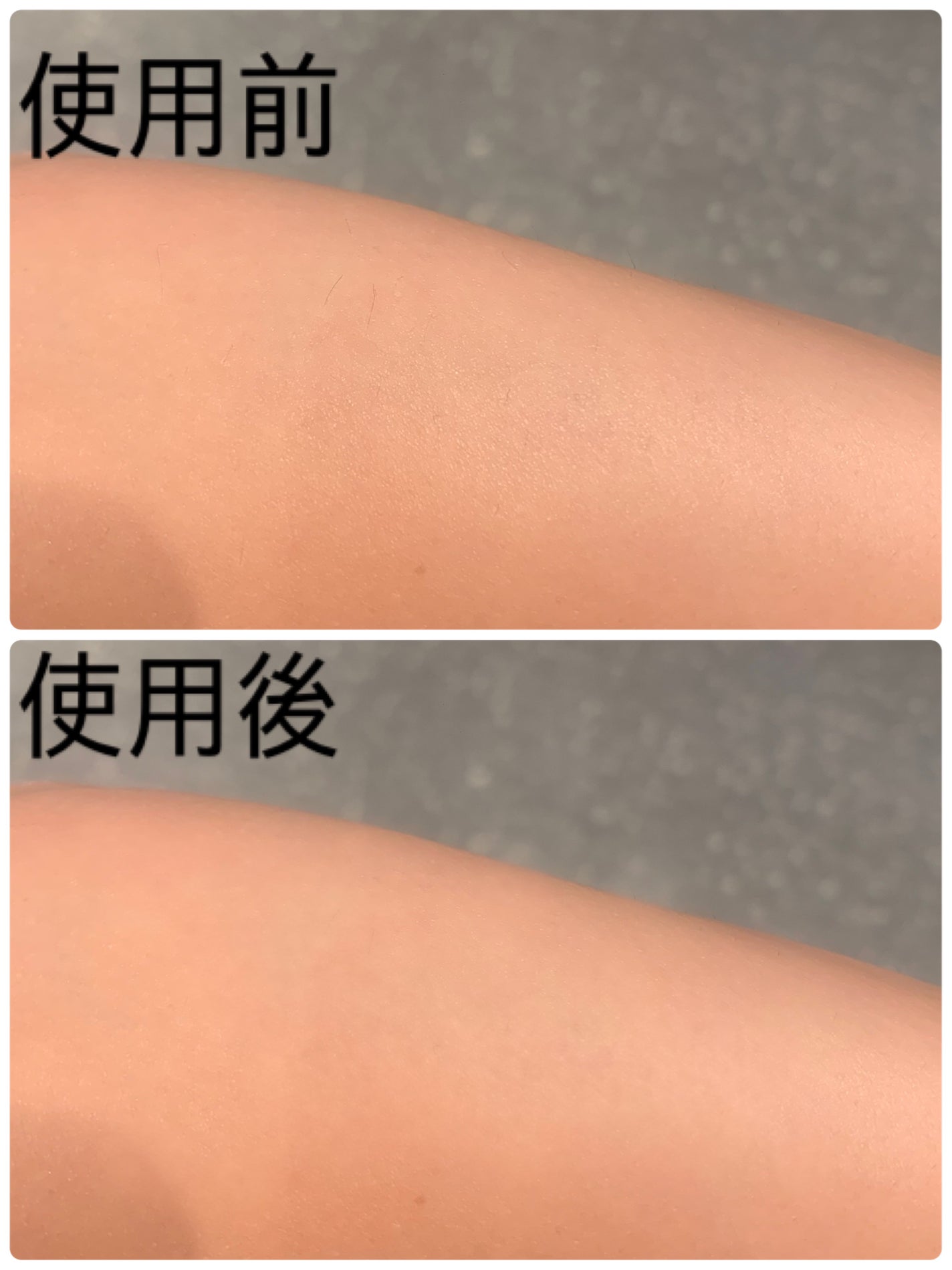 SIPL-1000C 家庭用光美容器/eosika/家庭用脱毛器を使ったクチコミ(4枚目)