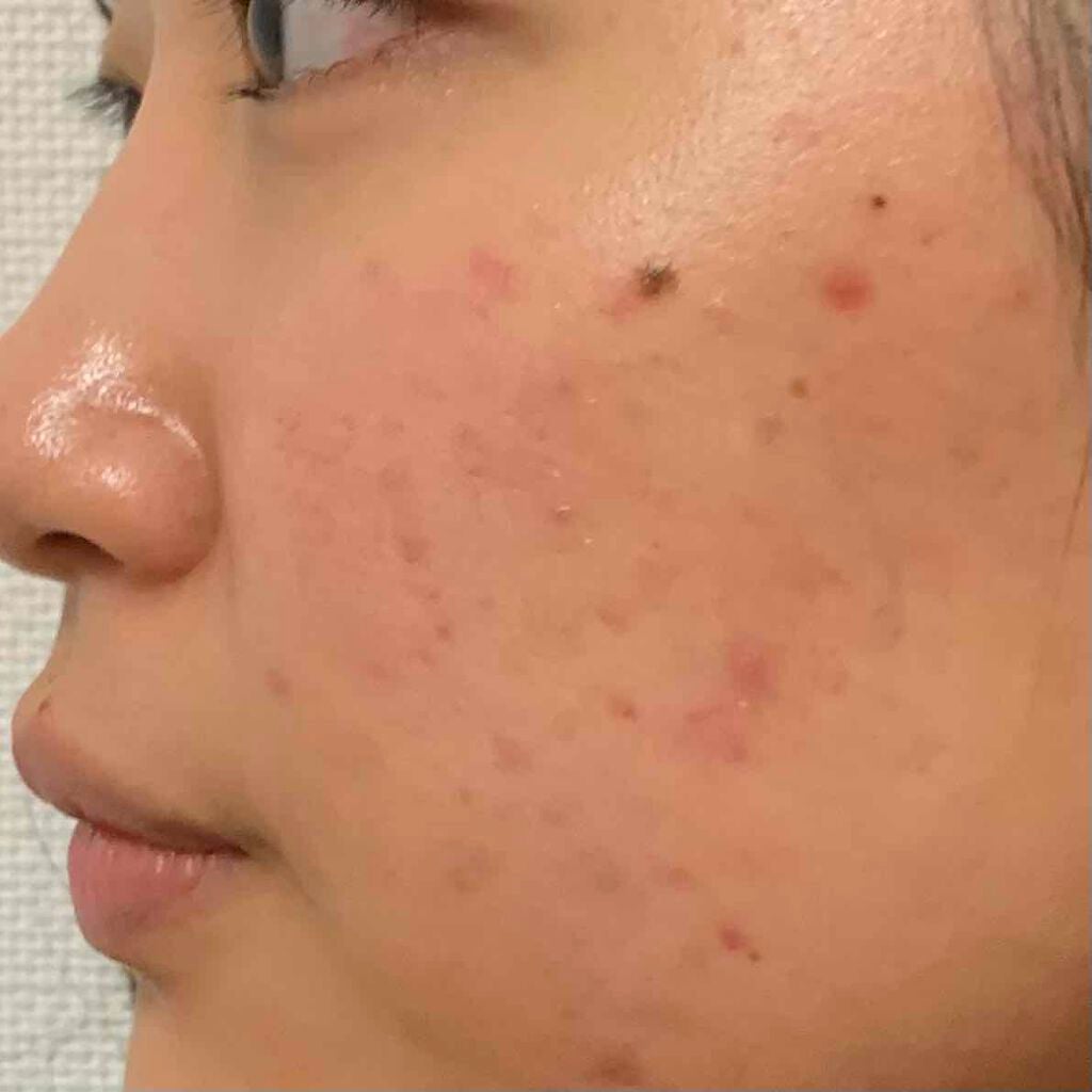 クリアウォッシュ/オルビス/洗顔フォームを使ったクチコミ(1枚目)