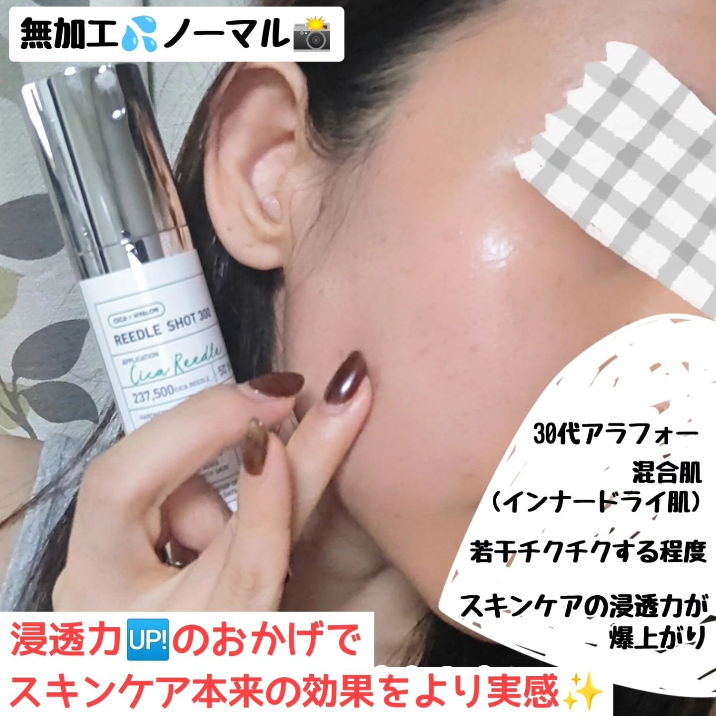 リードルショット100/VT/美容液を使ったクチコミ（2枚目）