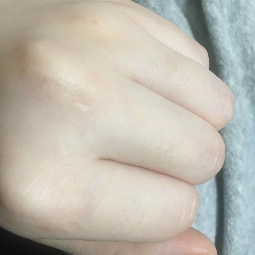 除毛クリーム シトラスホワイトリリィ/スリンキータッチ セルフスパ/除毛クリームを使ったクチコミ(2枚目)