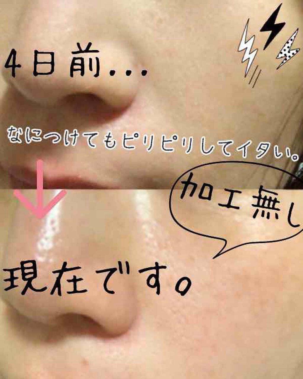 チョコラBBピュア (医薬品)/チョコラBB/その他を使ったクチコミ(2枚目)