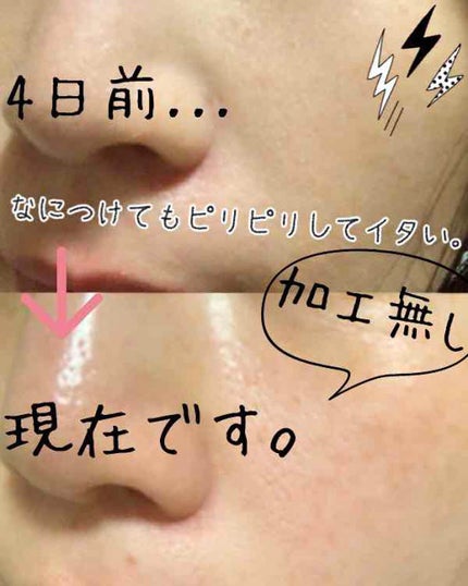 チョコラBBピュア (医薬品)/チョコラBB/その他を使ったクチコミ(2枚目)
