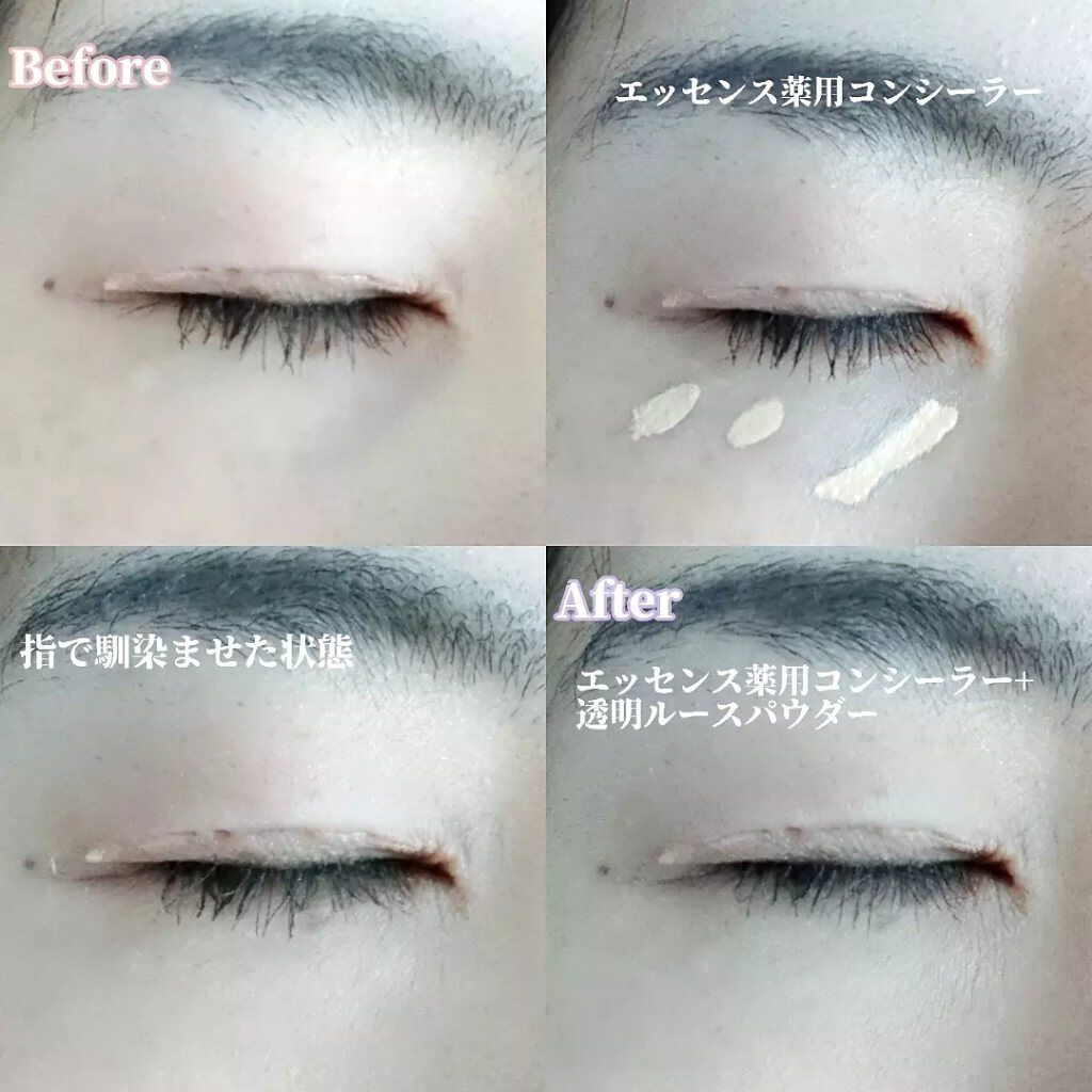 モイストラボ エッセンス薬用美白コンシーラー/Moist Labo/リキッドコンシーラーを使ったクチコミ(7枚目)