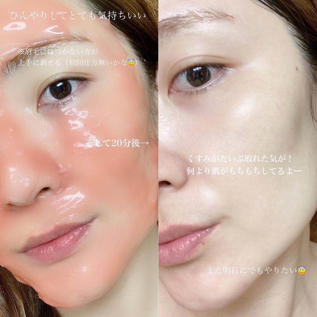 CO2 Gel Pack Pro 3P/10P/BELA VELA/シートマスク・パックを使ったクチコミ(4枚目)