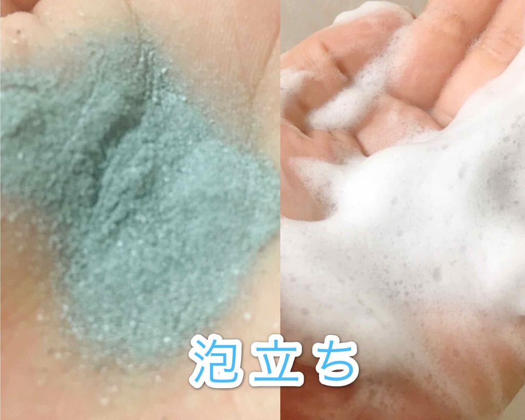 ウォーターピーリング/CaTiony/美顔器・マッサージを使ったクチコミ（3枚目）