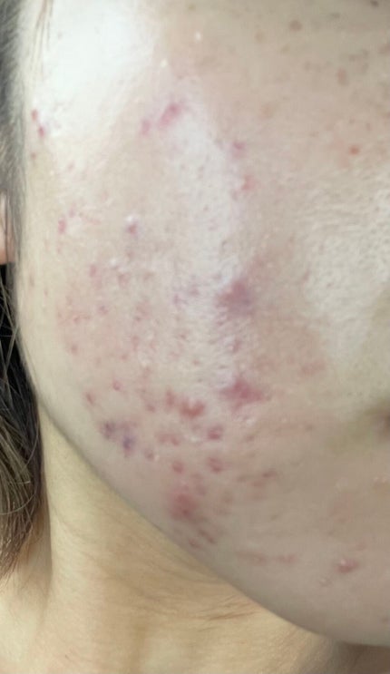 アルビオン 薬用スキンコンディショナー エッセンシャル/ALBION/化粧水を使ったクチコミ(1枚目)