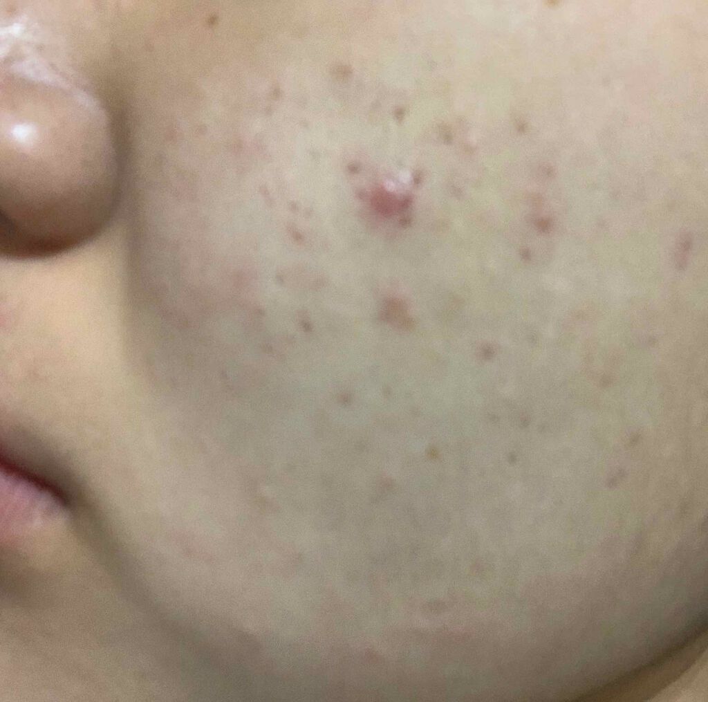 レイヴィーフォームフェイシャルウォッシュ ゴートミルク/Leivy/洗顔フォームを使ったクチコミ（2枚目）