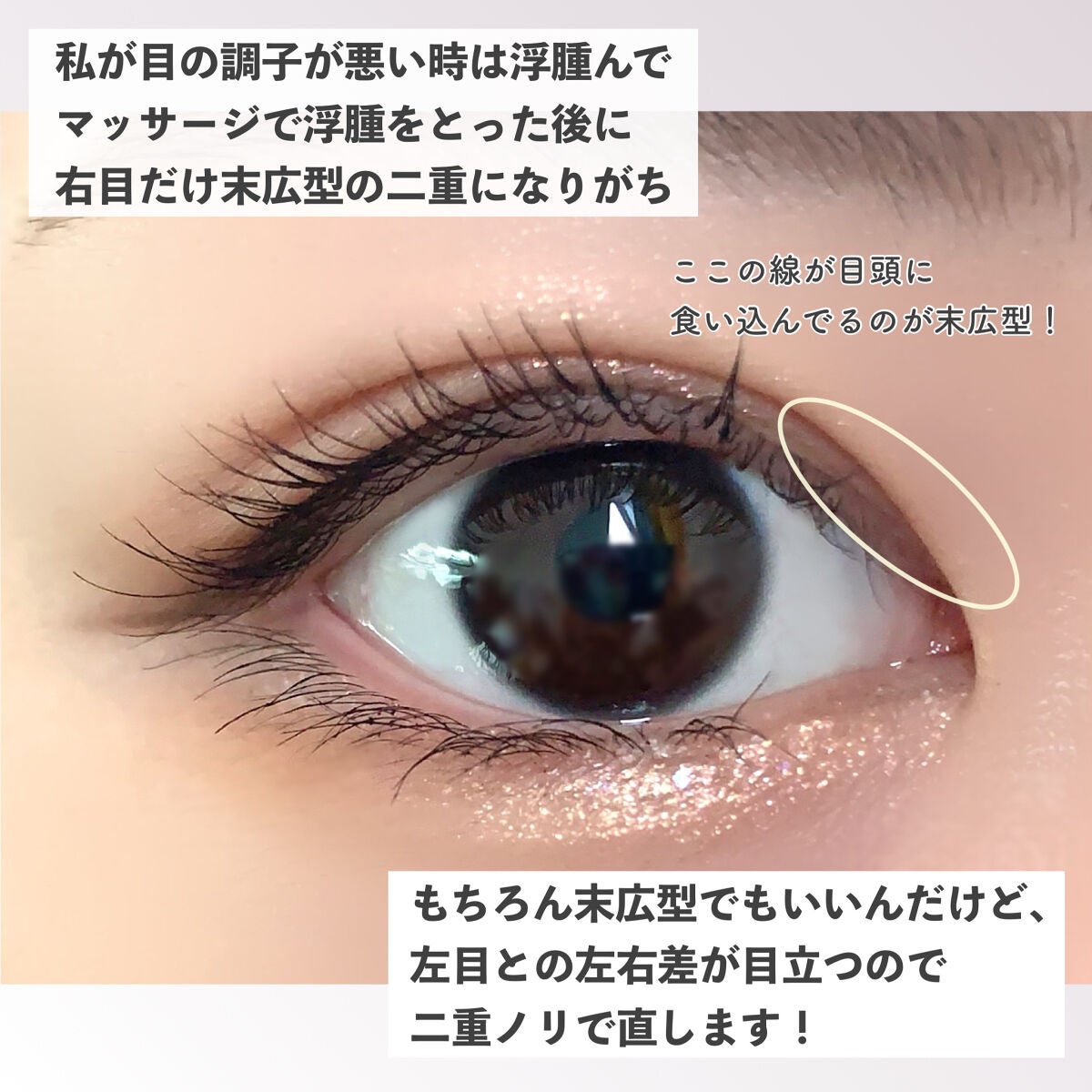 オリシキ アイリッドスキンフィルム /D-UP/二重まぶた用アイテムを使ったクチコミ(4枚目)