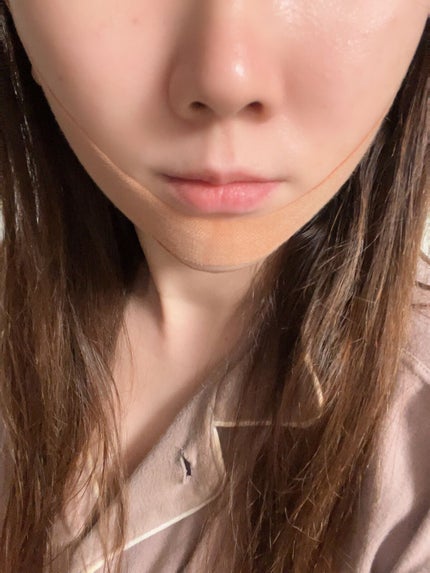試してみた】id FACE FIT MINUS BAND V2 id PLACOSMETICSの効果 試してみた】id FACE FIT MINUS BAND V2 id PLACOSMETICSの効果