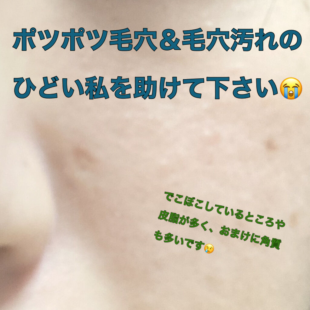 ロゼットゴマージュ/ロゼット/ピーリングを使ったクチコミ（1枚目）