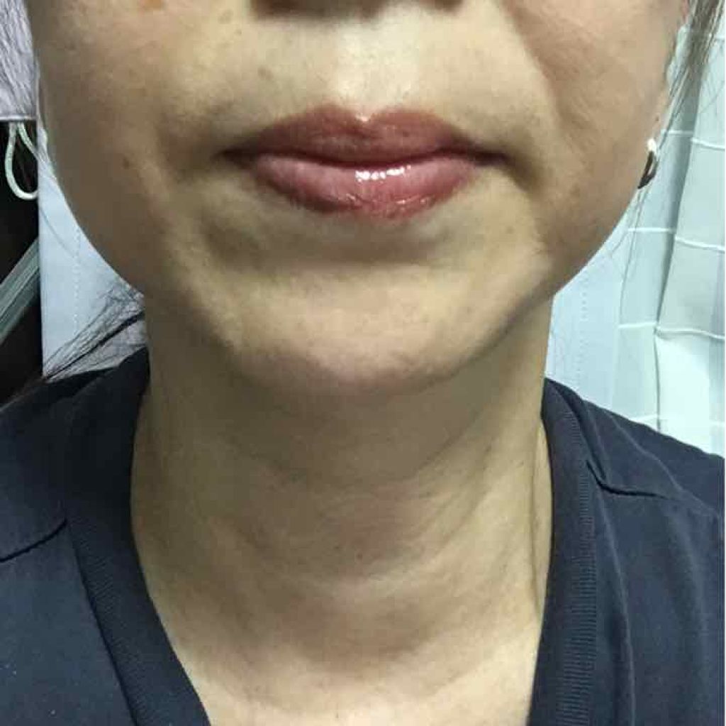 アクアクリーミィーエッセンス II/ドクターイノベール/乳液を使ったクチコミ（1枚目）