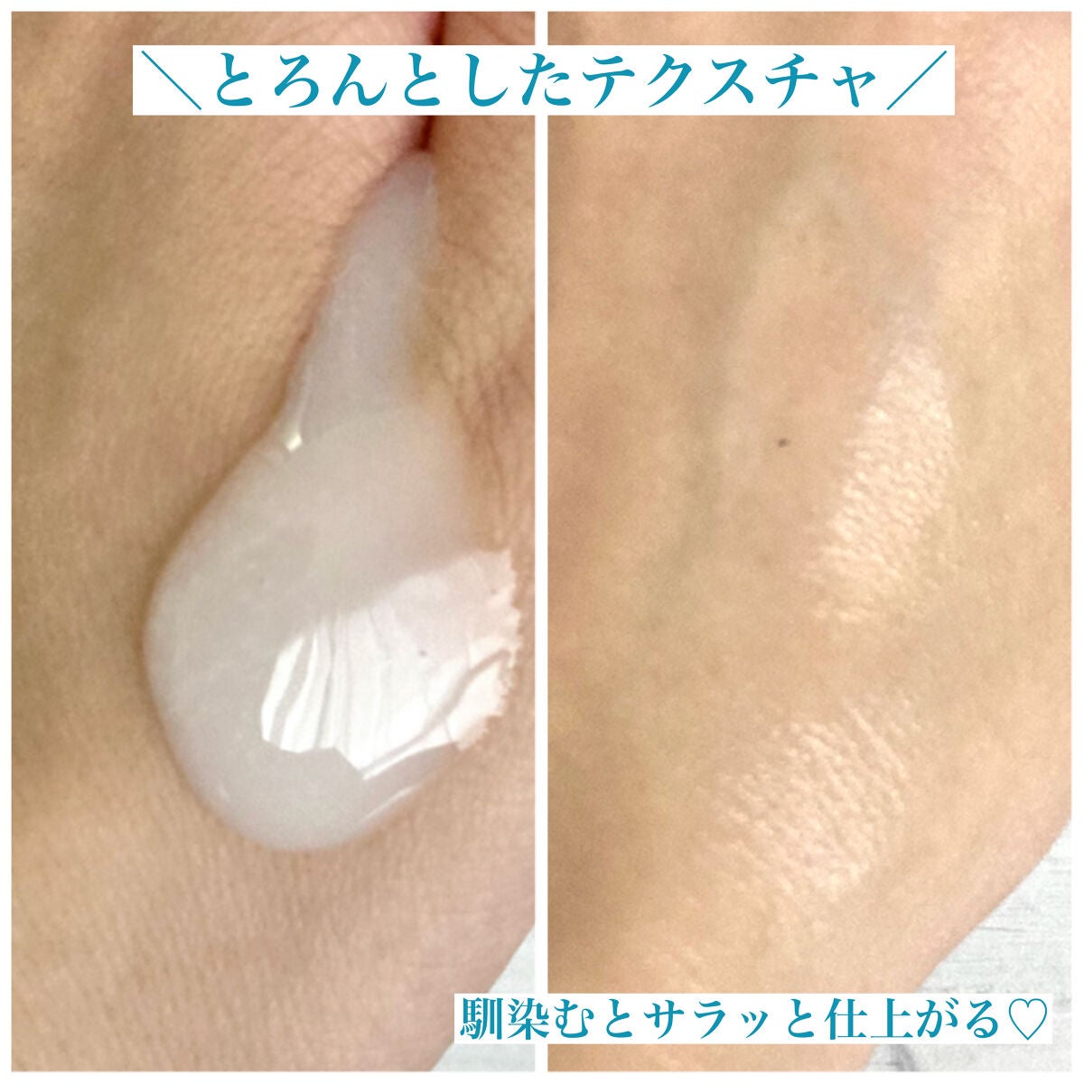 セラミエイド 薬用スキンミルク/セラミエイド/ボディミルクを使ったクチコミ(5枚目)