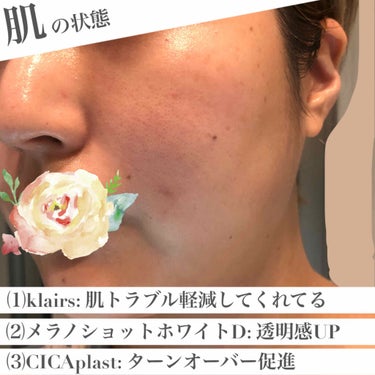 LA ROCHE POSAY(海外)  シカプラスト ボーム B5【海外版】のクチコミ「個人的な記録✍️
NEW✨シミ対策スキンケアライン実施中


----------------.....」（3枚目）