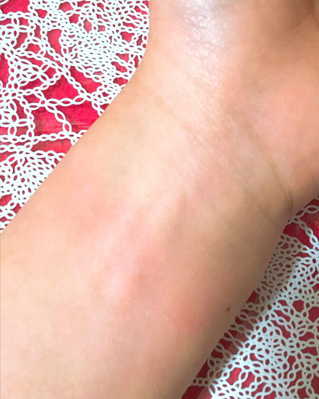 クリーミーチーク/エスポルール/ジェル・クリームチークを使ったクチコミ(4枚目)