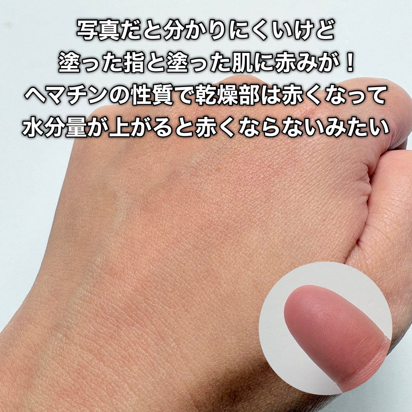 yuki/フォロバします❤️ on LIPS 「ATPLONRed“Red”っていう名前のこれは何だろう? か..」(7枚目)