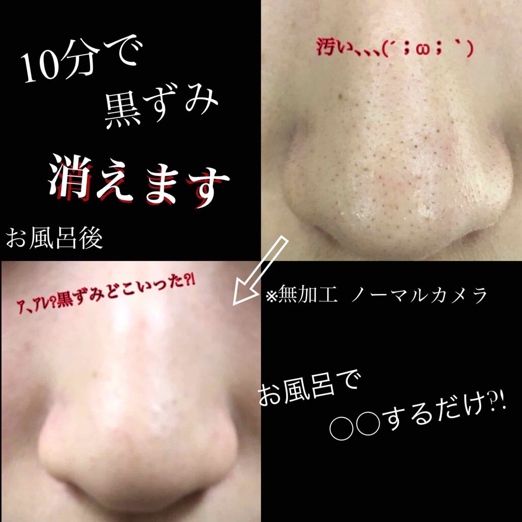 ニベアクリーム/ニベア/ボディクリームを使ったクチコミ（1枚目）