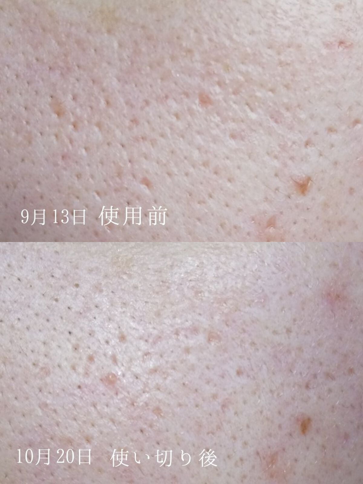 RXザ・ビタミンC23セラム/COSRX/美容液を使ったクチコミ(2枚目)