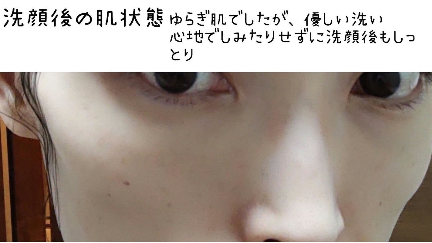 アミノ酸 ジェントル バブル クレンザー/Dr.Althea/泡洗顔を使ったクチコミ(3枚目)