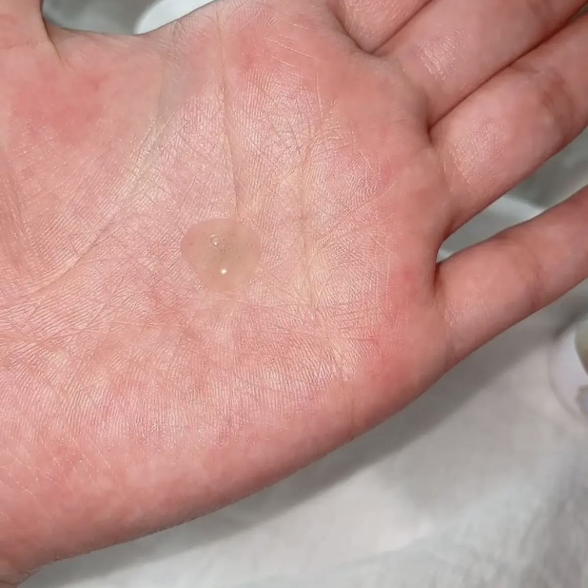 ピュアスキン セラミドセラム/Treat Treat(トリートトリート)/美容液を使ったクチコミ（3枚目）