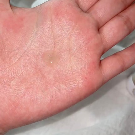 ピュアスキン セラミドセラム/Treat Treat(トリートトリート)/美容液を使ったクチコミ(3枚目)