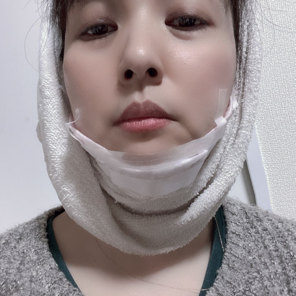 AHA 30% + BHA 2% Peeling Solution/The Ordinary/ピーリングを使ったクチコミ（1枚目）