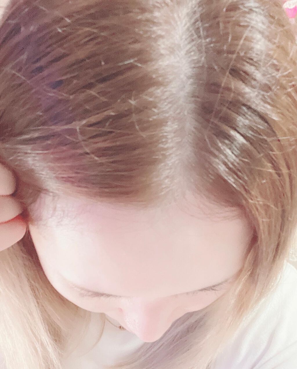 ヘアアクセルレーターEX フローラルアップルの香り/加美乃素本舗/頭皮ローションを使ったクチコミ(9枚目)