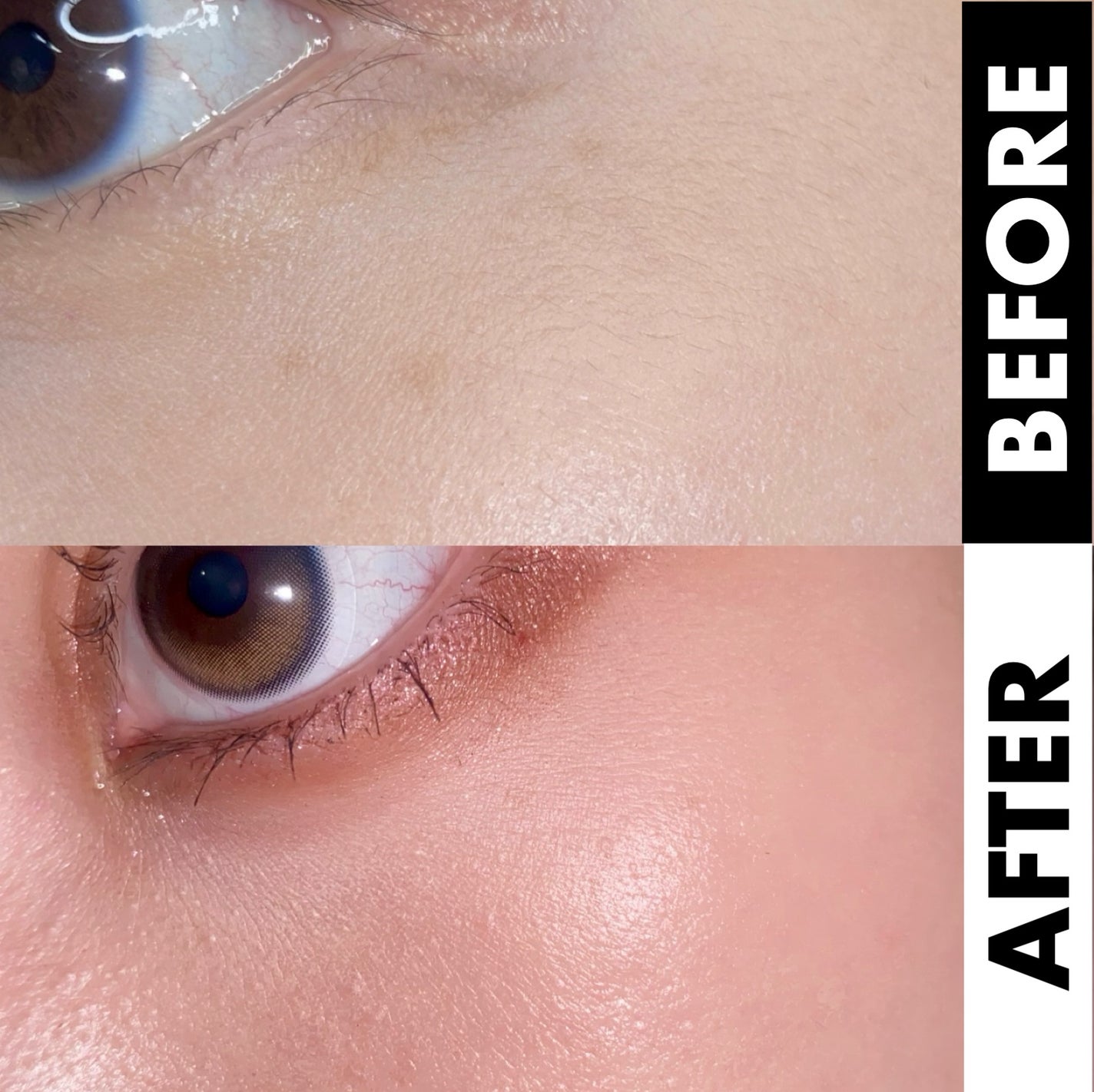 スキムシェーバー/ReFa/シェーバーを使ったクチコミ(5枚目)