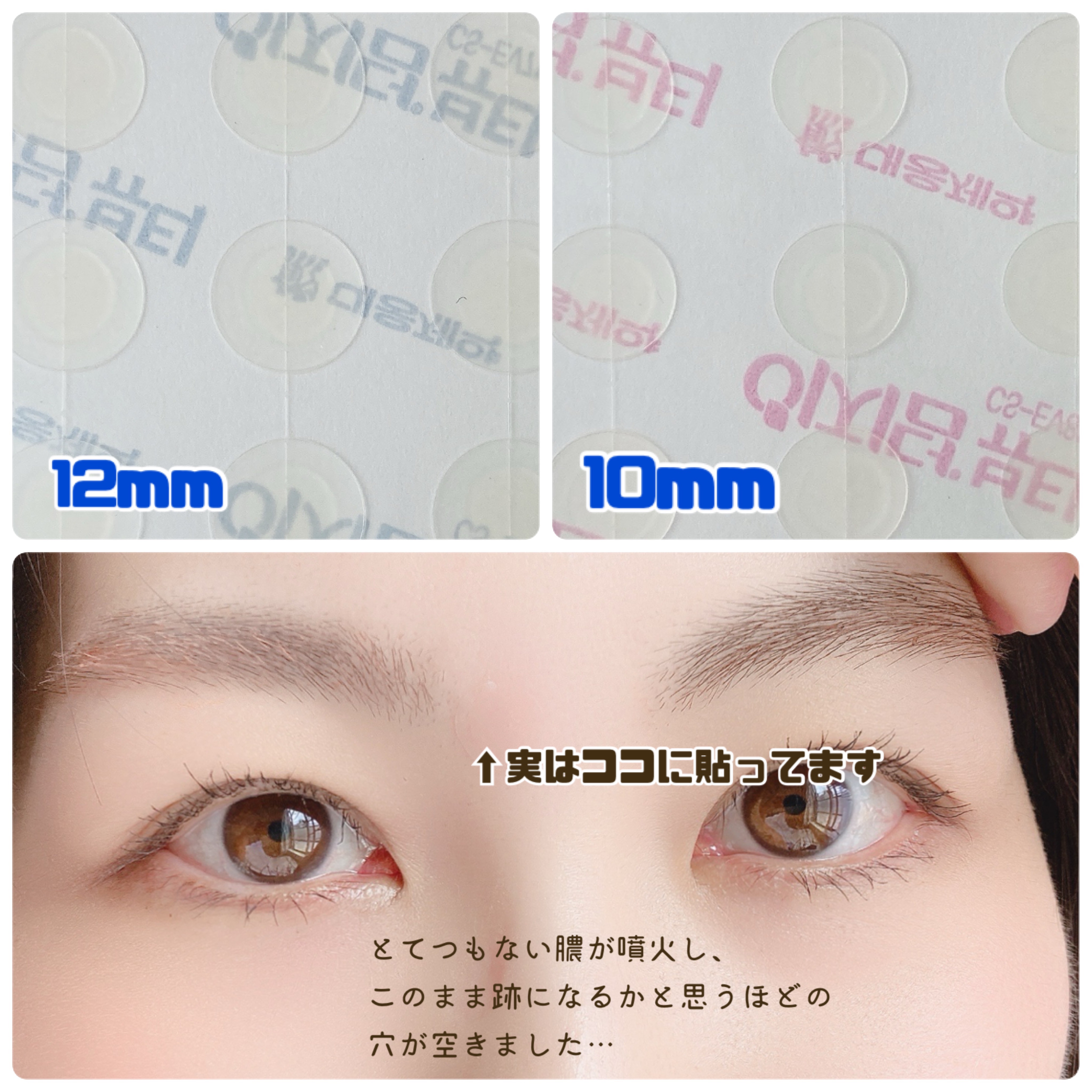 ビューティー スポットパッチ/イージーダムビューティー/にきびパッチを使ったクチコミ（3枚目）