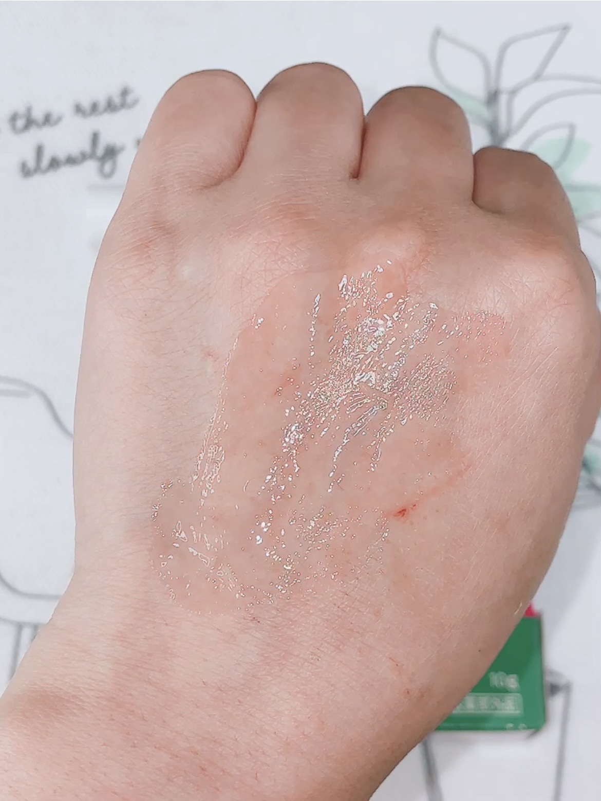 ニキビあとケアジェル/アットノン/その他スキンケアを使ったクチコミ（3枚目）