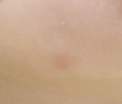 リポソーム アドバンスト リペアセラム/DECORTÉ/美容液を使ったクチコミ(2枚目)