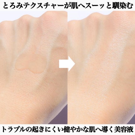 ファイン100/imini/美容液を使ったクチコミ(4枚目)