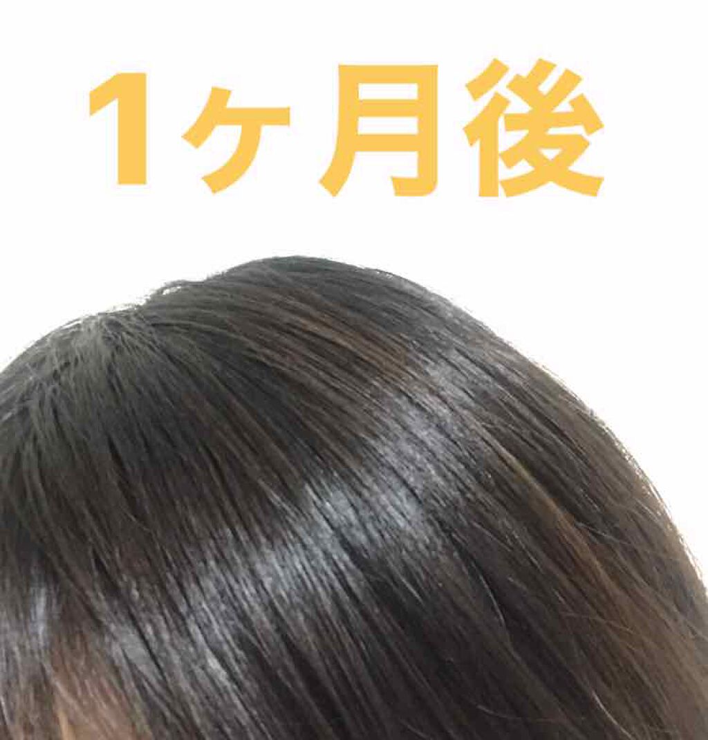泡カラー 髪色もどし/リーゼ/ヘアカラーを使ったクチコミ(4枚目)
