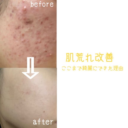 潤浸保湿 フェイスクリーム/キュレル/フェイスクリームを使ったクチコミ(1枚目)