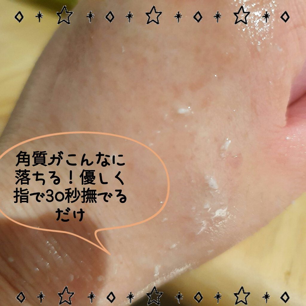 フェイシャルマイルドピーリング/primera/ピーリングを使ったクチコミ(5枚目)