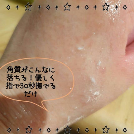 フェイシャルマイルドピーリング/primera/ピーリングを使ったクチコミ(5枚目)