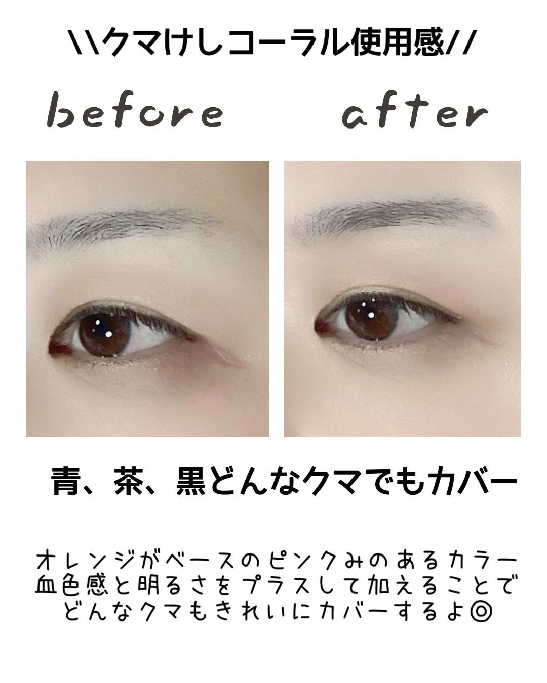 エテュセ スキンフィット カバーコンシーラー/ettusais/クリームコンシーラーを使ったクチコミ（3枚目）