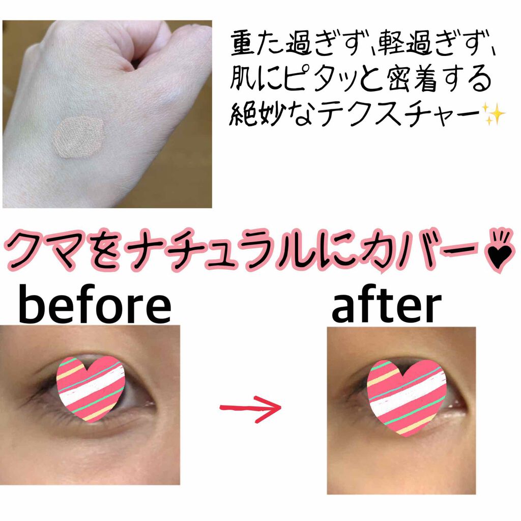 【旧】ディオールスキン フォーエヴァー スキン コレクト コンシーラー/Dior/リキッドコンシーラーを使ったクチコミ（2枚目）