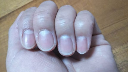 アボプレックス キューティクルオイル トゥーゴー/O・P・I/ネイルオイル・トリートメントを使ったクチコミ(2枚目)