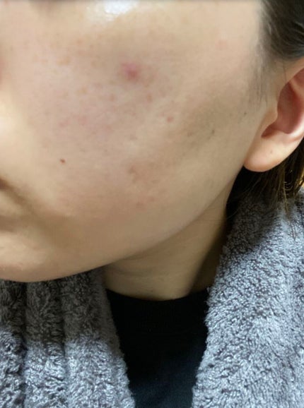 コスメティック フレンド(コスメティックボーイ)/ラッシュ/フェイスクリームを使ったクチコミ(4枚目)