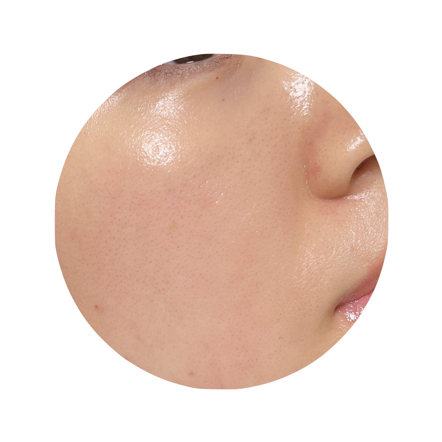 バイタルイミュンショットファーストバブルセラム/SKIN SIGNAL/美容液を使ったクチコミ(4枚目)