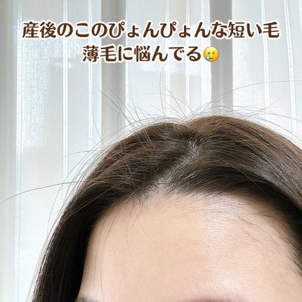 薬用育毛剤/マイナチュレ/頭皮ローションを使ったクチコミ(2枚目)