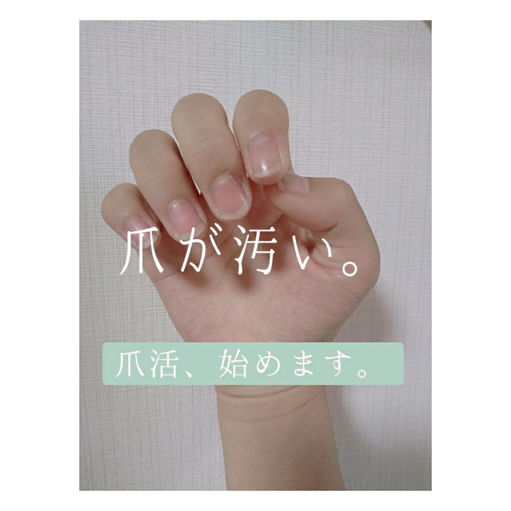 エテュセ クイックケアコート/ettusais/ネイルオイル・トリートメントを使ったクチコミ（1枚目）