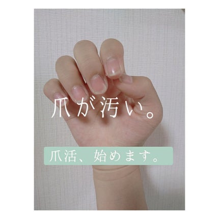 エテュセ クイックケアコート/ettusais/ネイルオイル・トリートメントを使ったクチコミ(1枚目)