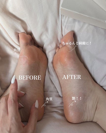 ゴウンバル クリーム/3WB/レッグ・フットケアを使ったクチコミ(3枚目)