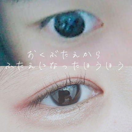 のびーるアイテープ(絆創膏タイプ、レギュラー)/DAISO/二重まぶた用アイテムを使ったクチコミ(1枚目)