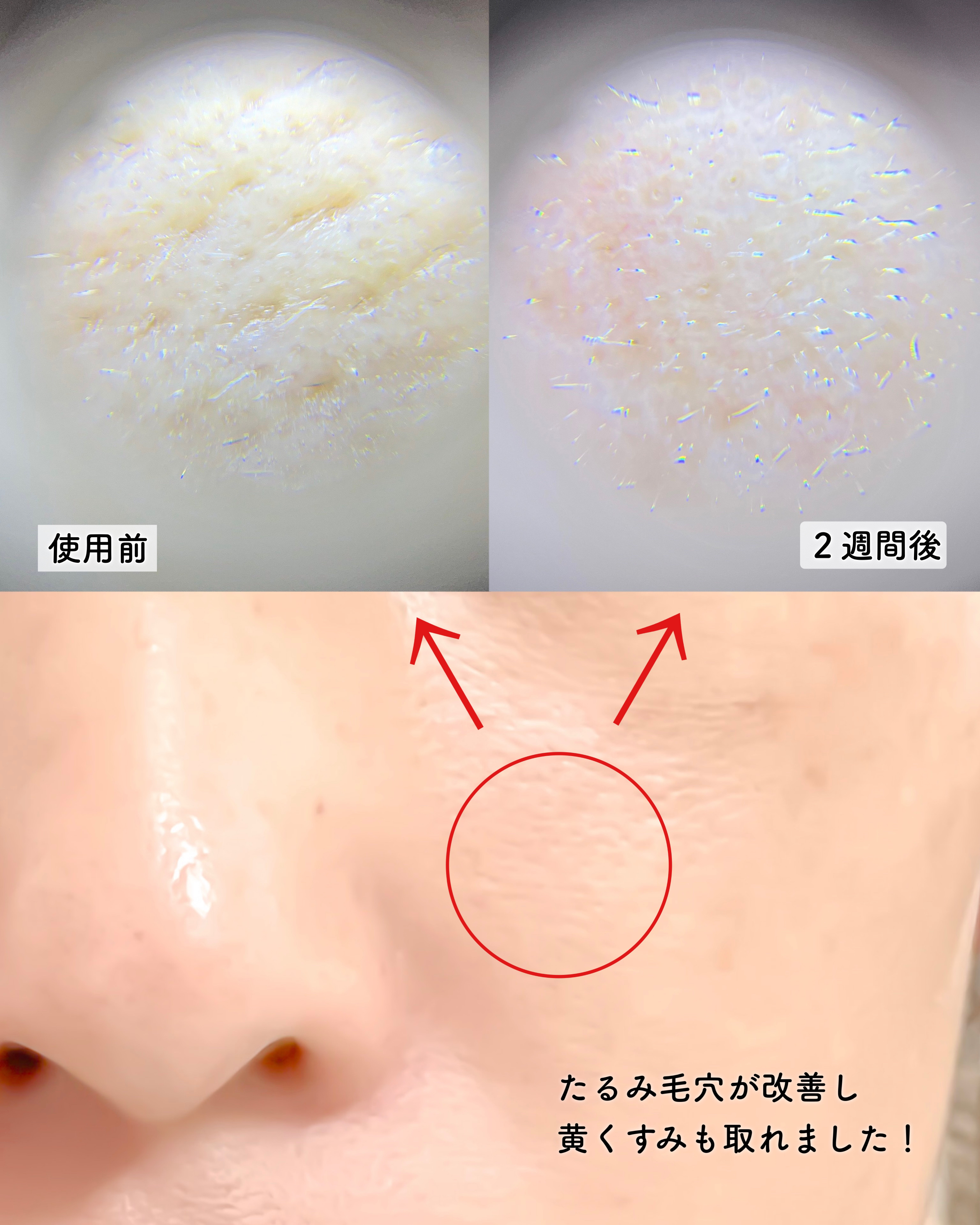 リードルショット300/VT/美容液を使ったクチコミ（2枚目）