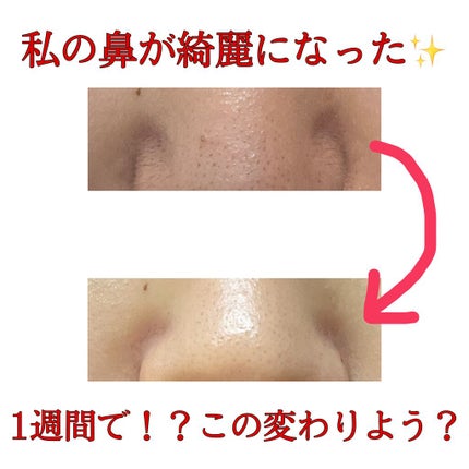 ハトムギ化粧水(ナチュリエ スキンコンディショナー R )/ナチュリエ/化粧水を使ったクチコミ(1枚目)